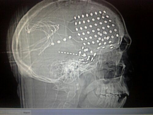 wpid-20140127_125404